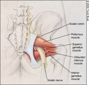 sciatic nerve pain caused by the piriformis
